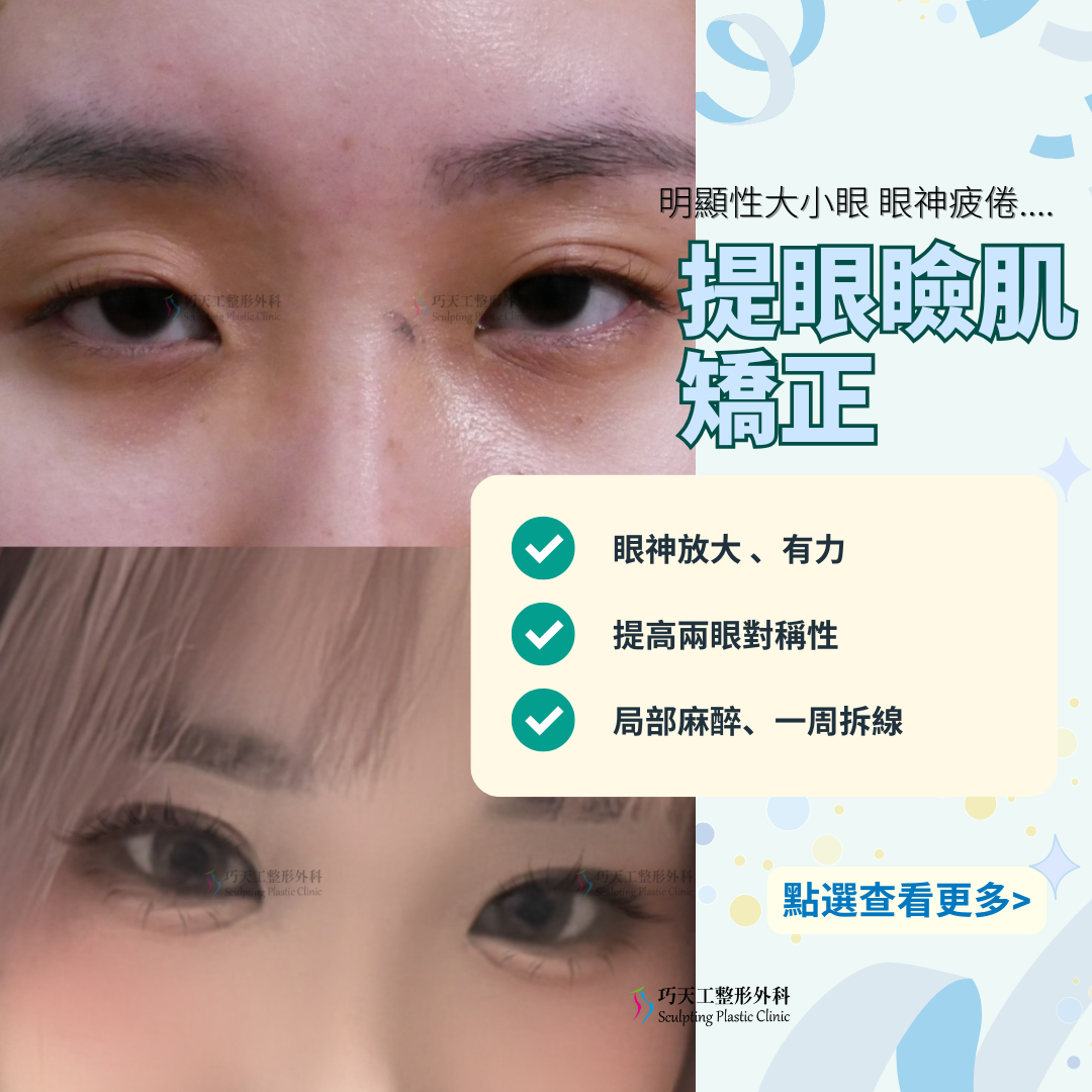 提眼瞼肌矯正手術