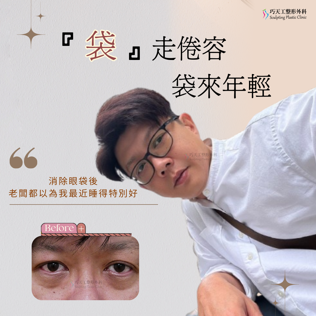 眼袋手術